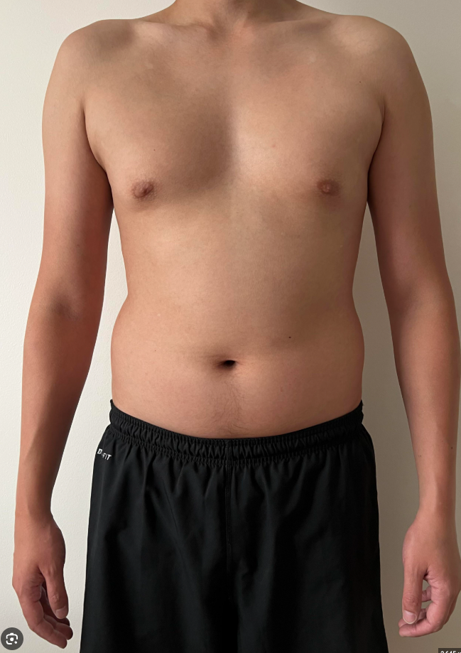 Before transformation